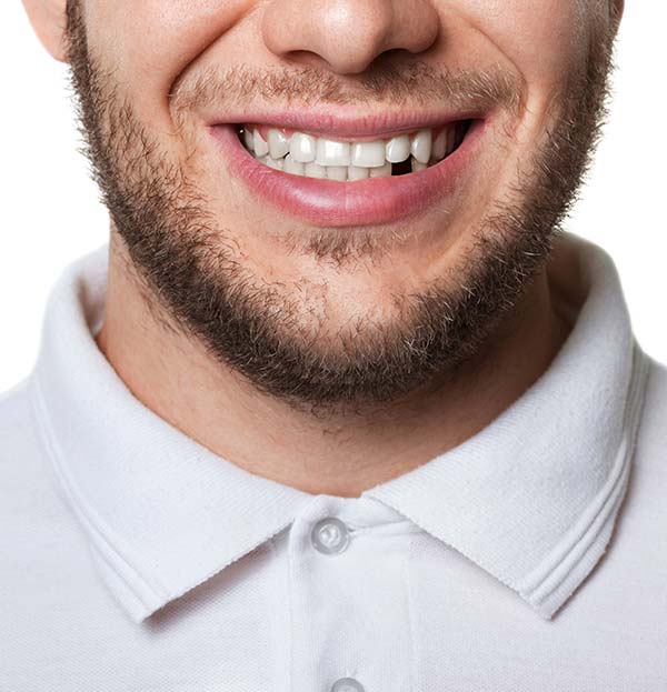 Missing-Teeth-Treatment-at-Elwood-Family-Dentist-Practice
